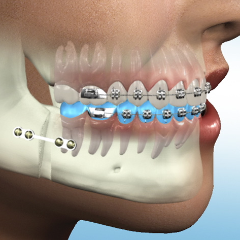 Στοματική Χειρουργική