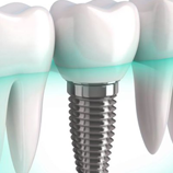 Εμφυτευματολογία