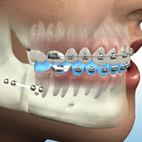 Στοματική Χειρουργική